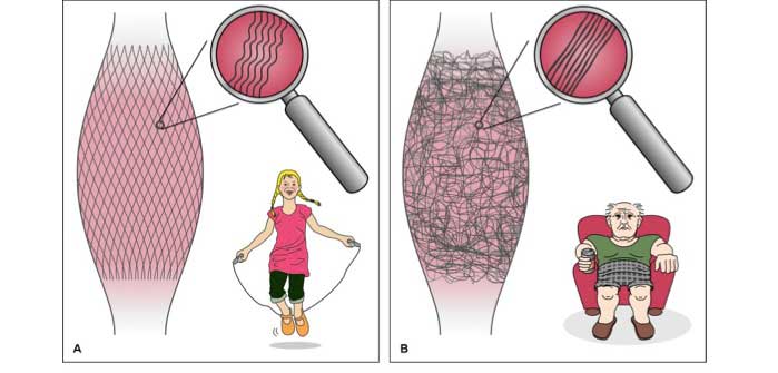 Faszientraining & Faszienfitness in Bornheim